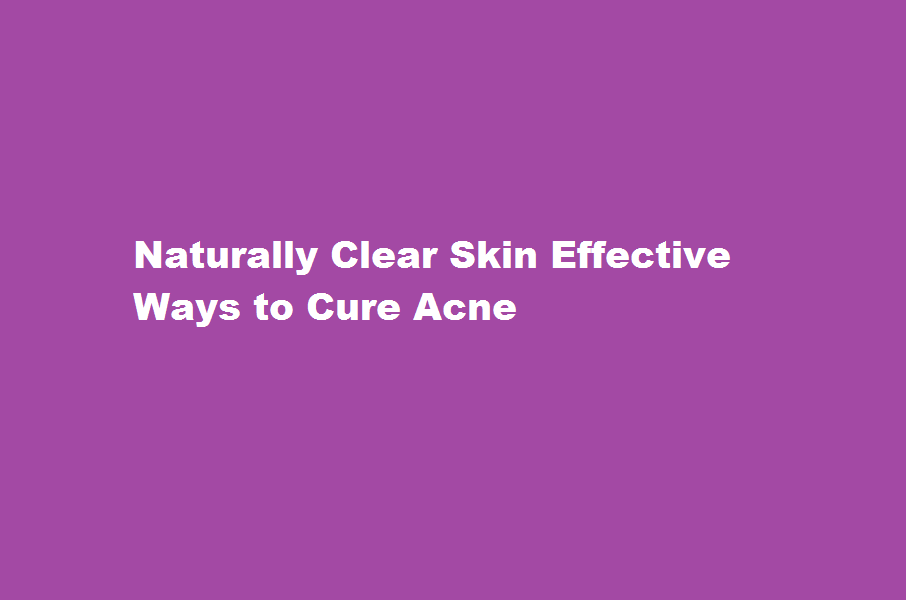 how to cure acnes naturally