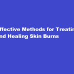 how to cure skin burn